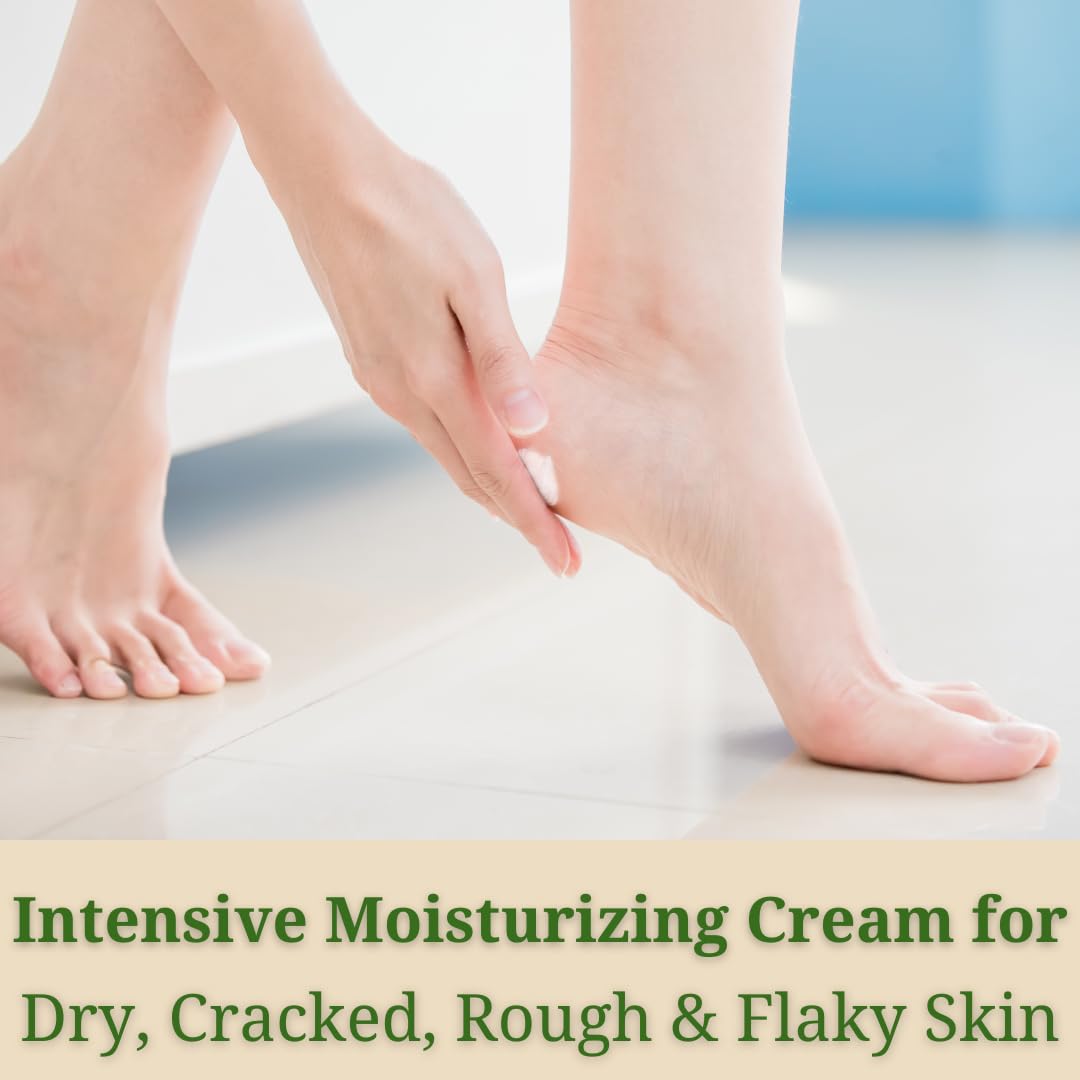 UniSonym Peppermint + Rosemary, Eucalyptus & Tea Tree Foot Cream for Dry Cracked Heels and Feet - Moisturizing Foot Lotion for Cracked Heel Repair - Callus Remover with Lactic Acid (4 oz)